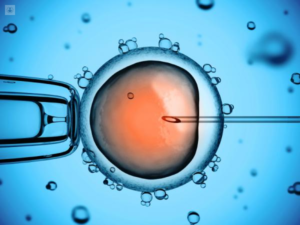 Fecundacion In Vitro (FIV)